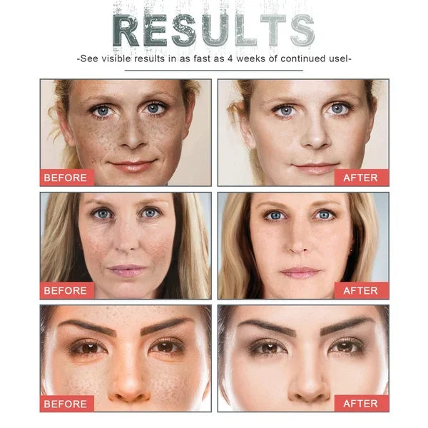 【Official Brand Store】HZA™ Retinol Face Cream(🔥Limited Time Discount)