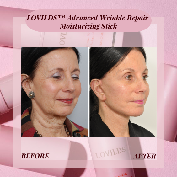 💝 Last Day Discount - 50%𝐎𝐅𝐅 💝𝓛𝓞𝓥𝓘𝓛𝓓𝓢™ Advanced Wrinkle Repair Moisturizing Stick