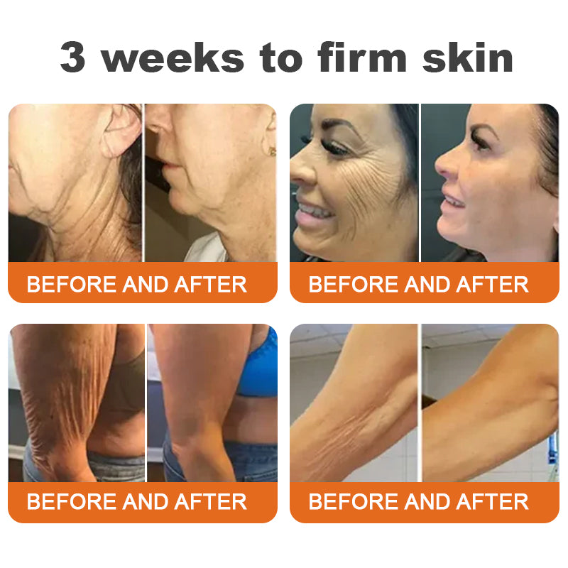 Made and Shipped from USA✨ BBOJI® Botulinum Toxin BEE VENOM Firming Serum Stick(🔥LAST DAY 70% OFF)💄