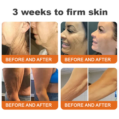 Made and Shipped from USA✨ BBOJI® Botulinum Toxin BEE VENOM Firming Serum Stick(🔥LAST DAY 70% OFF)💄